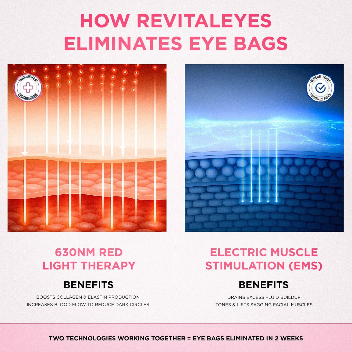 AloraEyes® 2-in-1 Red Light Therapy + EMS To Erase Eye Bags