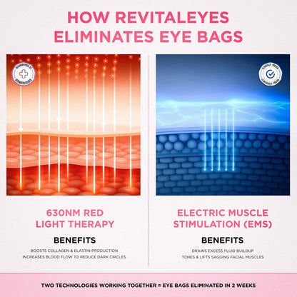 AloraEyes® 2-in-1 Red Light Therapy + EMS To Erase Eye Bags