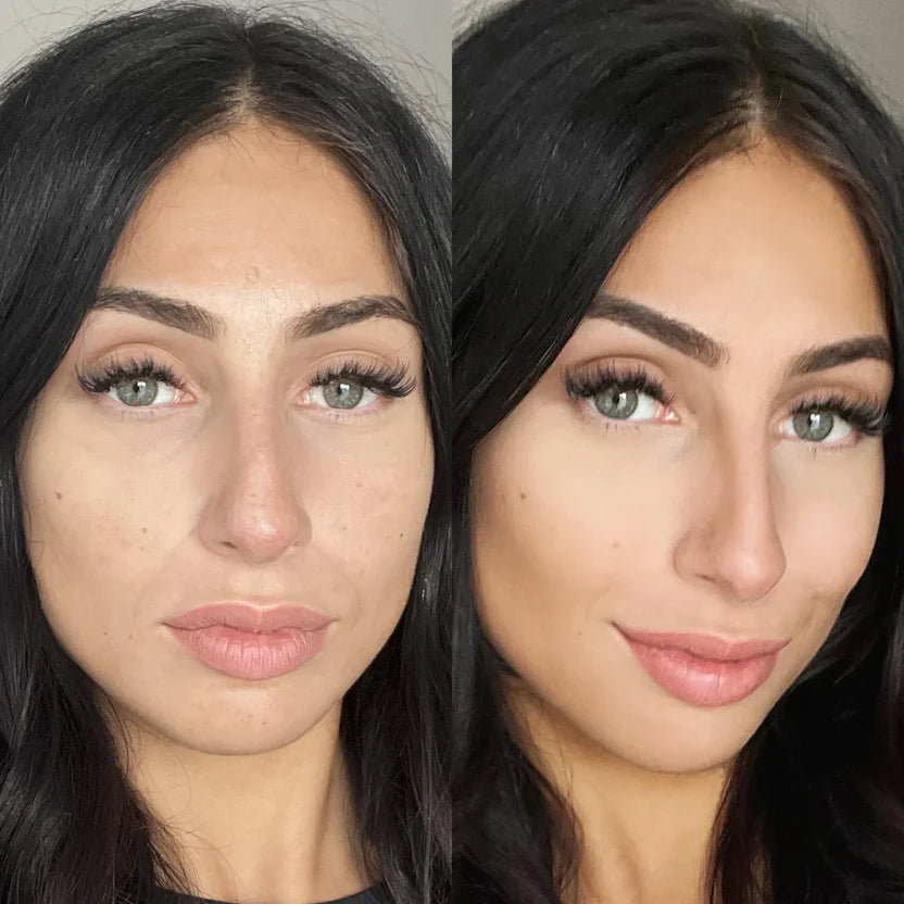 Treat Fine Lines and Wrinkles