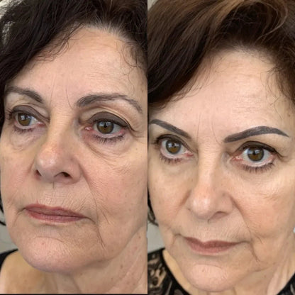 AloraEyes® 2-in-1 Red Light Therapy + EMS To Erase Eye Bags